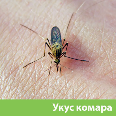 Укусы комаров в Ногинске